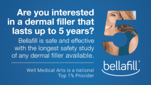 Bellafill is the longest lasting filler available. Dominique Well at Well Medical Arts is the #2 ranked Bellafill provider in the nation. 