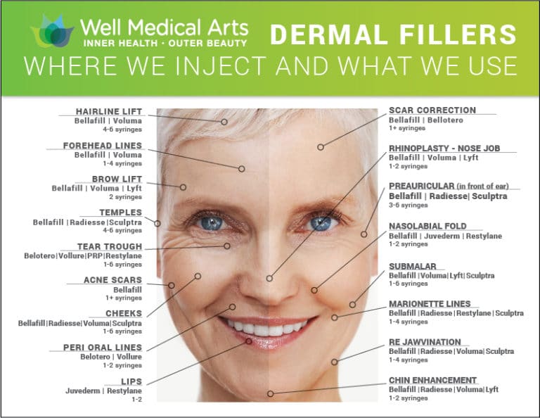 Dermal FillersMapSeattleWellMedicalArts8X1101 Well Medical