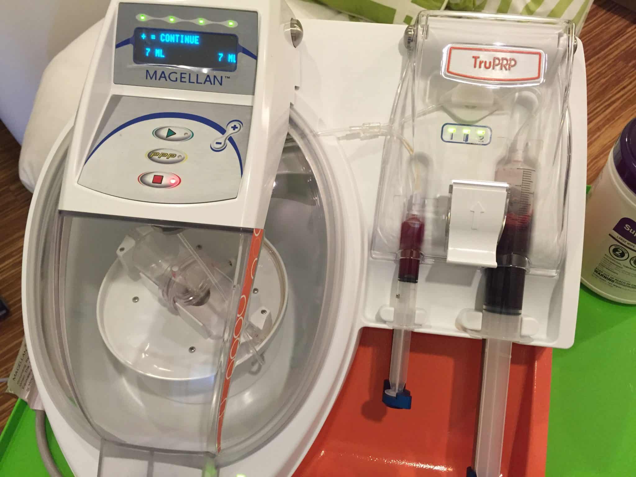 Spinning up the PRP (platelet rich plasma) in Seattle and getting ready for a vampire facial.