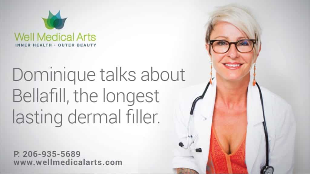 Bellafill is the longest lasting dermal filler available, lasting up to 5 years. Bellafill is available at Well Medical Arts in Seattle.