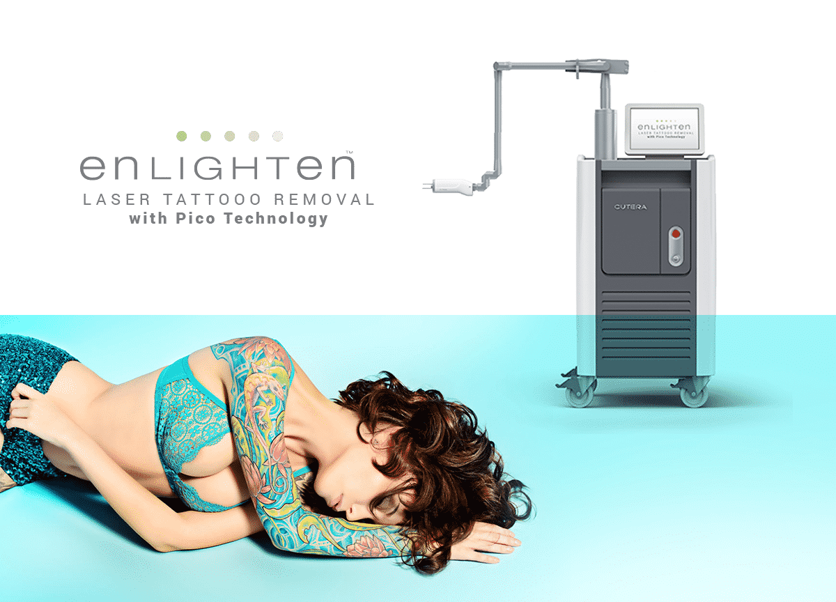 The Cutera Enlighten with Picosecond technology is the most advanced tattoo removal laser on the market