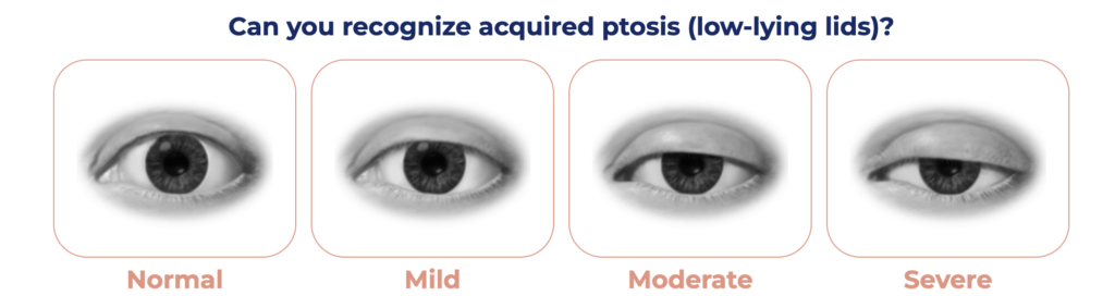 Upneeq available in Seattle at Well Medical Arts.