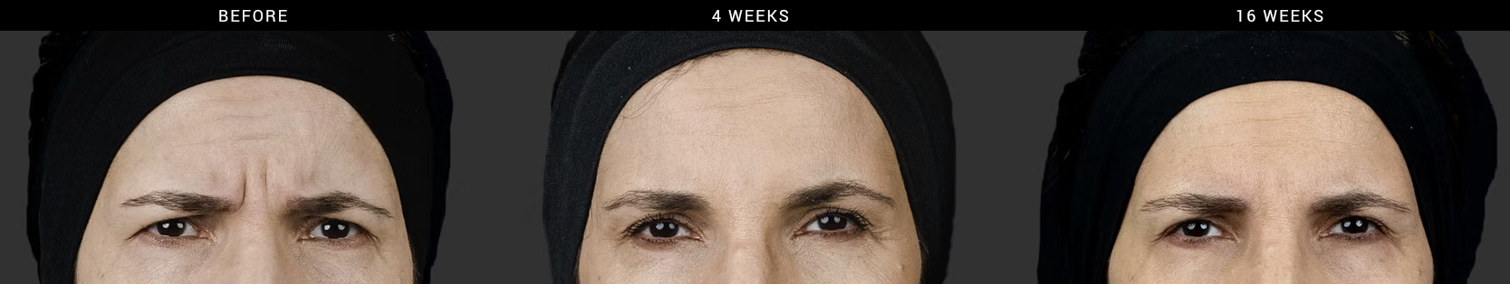 Letybo - Before and After