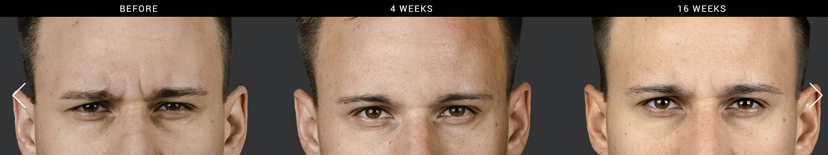Letybo Before and after men
